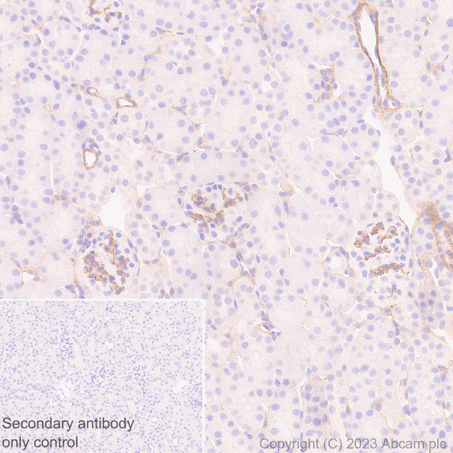Immunohistochemistry (Formalin/PFA-fixed paraffin-embedded sections) - Anti-RGS5 antibody [EPR28539-64] (ab314670), expandable thumbnail