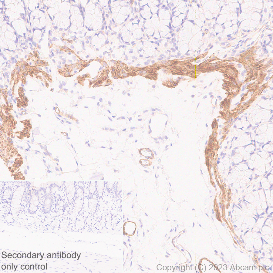 Immunohistochemistry (Formalin/PFA-fixed paraffin-embedded sections) - Anti-RGS5 antibody [EPR28539-64] (AB314670), expandable thumbnail