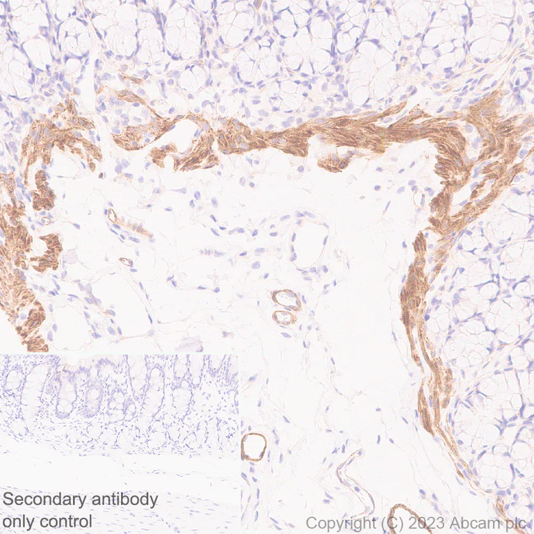 Immunohistochemistry (Formalin/PFA-fixed paraffin-embedded sections) - Anti-RGS5 antibody [EPR28539-64] (AB314670)