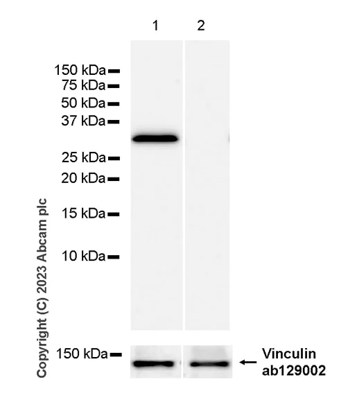 Western blot - Anti-RGS5 antibody [EPR28539-64] (AB314670)