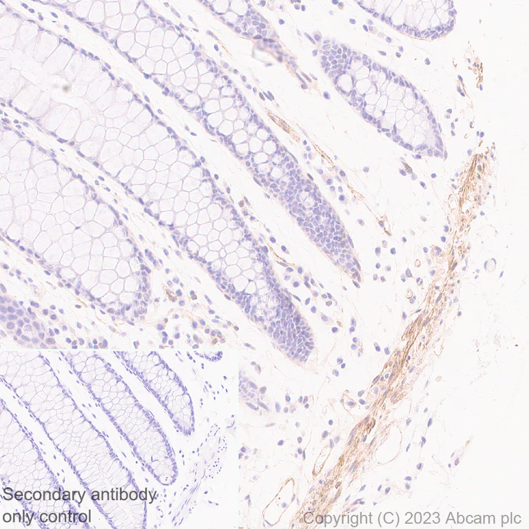 Immunohistochemistry (Formalin/PFA-fixed paraffin-embedded sections) - Anti-RGS5 antibody [EPR28539-64] - BSA and Azide free (AB314671)