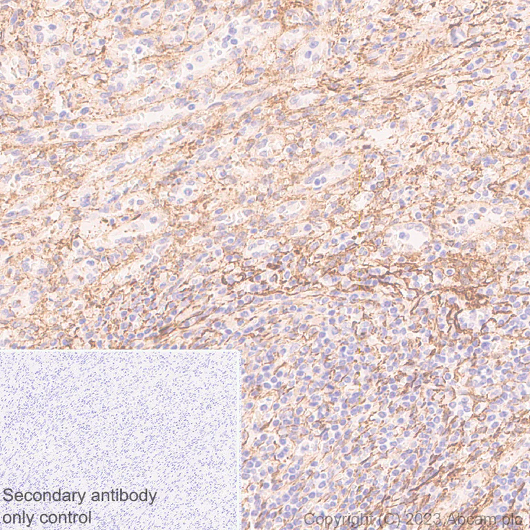 Immunohistochemistry (Formalin/PFA-fixed paraffin-embedded sections) - Anti-RGS5 antibody [EPR28539-64] - BSA and Azide free (AB314671)
