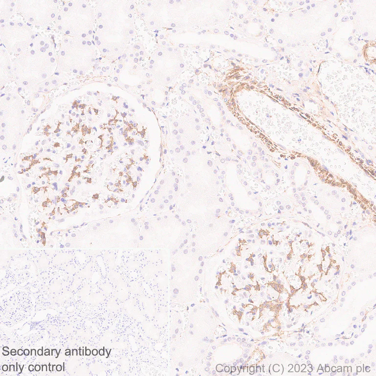 Immunohistochemistry (Formalin/PFA-fixed paraffin-embedded sections) - Anti-RGS5 antibody [EPR28539-64] - BSA and Azide free (AB314671)