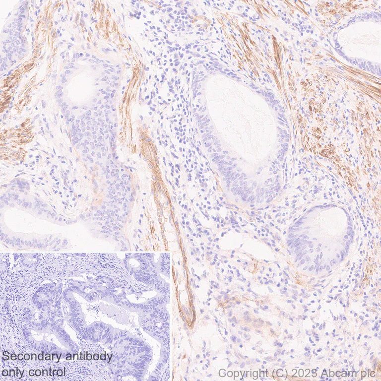 Immunohistochemistry (Formalin/PFA-fixed paraffin-embedded sections) - Anti-RGS5 antibody [EPR28539-64] - BSA and Azide free (AB314671)
