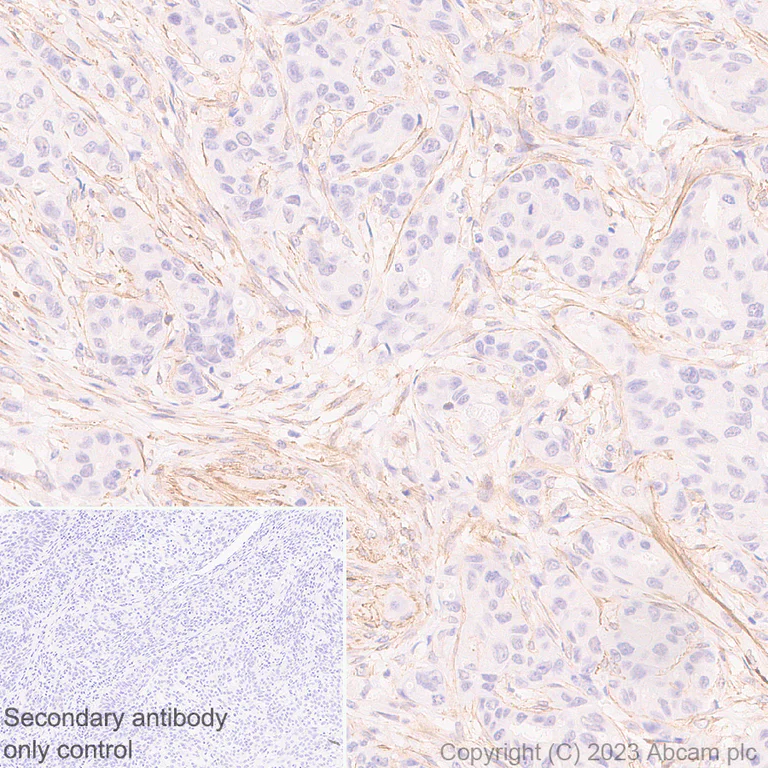 Immunohistochemistry (Formalin/PFA-fixed paraffin-embedded sections) - Anti-RGS5 antibody [EPR28539-64] - BSA and Azide free (AB314671)