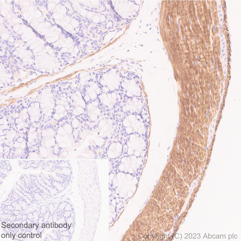 Immunohistochemistry (Formalin/PFA-fixed paraffin-embedded sections) - Anti-RGS5 antibody [EPR28539-64] - BSA and Azide free (AB314671)