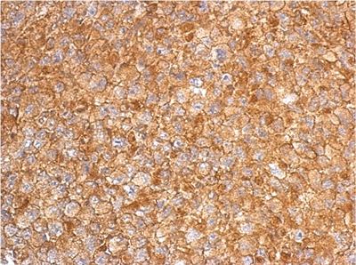 Immunohistochemistry (Formalin/PFA-fixed paraffin-embedded sections) - Anti-RGS6 antibody (AB155809), expandable thumbnail