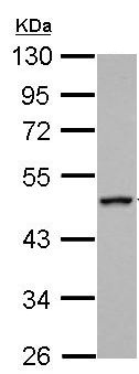 Western blot - Anti-RGS6 antibody (AB155809), expandable thumbnail