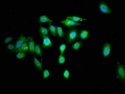 Immunocytochemistry/ Immunofluorescence - Anti-RGS6 antibody (AB236787)