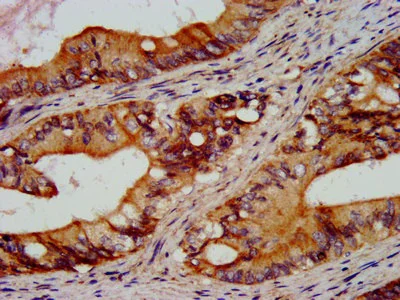 Immunohistochemistry (Formalin/PFA-fixed paraffin-embedded sections) - Anti-RGS6 antibody (AB236787)