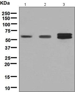 Western blot - Anti-RGS6 antibody [EPR6342] (AB128943)