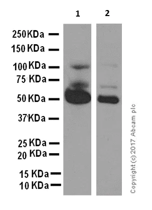 Western blot - Anti-RGS6 antibody [EPR6342] (AB128943)