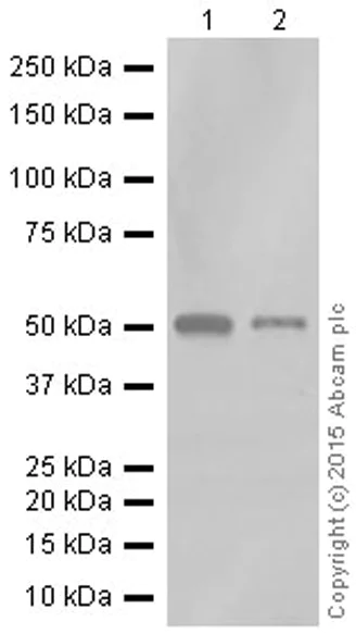 Western blot - Anti-RGS9 antibody [EPR2873] (AB108975)