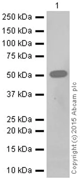 Western blot - Anti-RGS9 antibody [EPR2873] (AB108975)