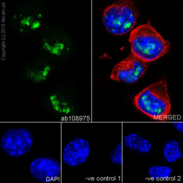 Immunocytochemistry/ Immunofluorescence - Anti-RGS9 antibody [EPR2873] - BSA and Azide free (AB247728)