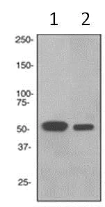 Western blot - Anti-RGS9 antibody [EPR2873] - BSA and Azide free (AB247728)
