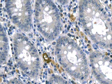Immunohistochemistry (Formalin/PFA-fixed paraffin-embedded sections) - Anti-RHAG antibody [EPR10011] (AB155094)