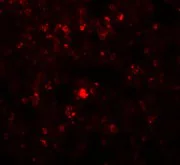 Immunocytochemistry/ Immunofluorescence - Anti-RHBDD2 antibody (AB106403)