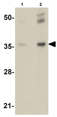 Western blot - Anti-RHBDD2 antibody (AB106403)