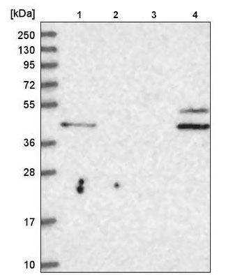 Western blot - Anti-RHBG antibody (AB220043), expandable thumbnail