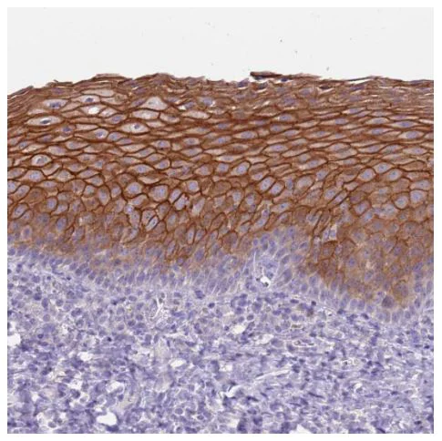 Immunohistochemistry (Formalin/PFA-fixed paraffin-embedded sections) - Anti-RHCG antibody (AB187904)