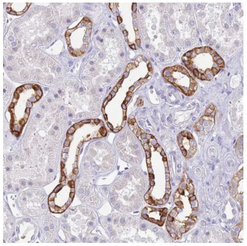 Immunohistochemistry (Formalin/PFA-fixed paraffin-embedded sections) - Anti-RHCG antibody (AB187904)