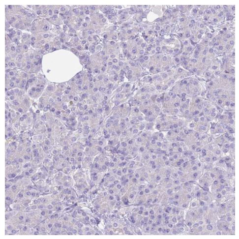 Immunohistochemistry (Formalin/PFA-fixed paraffin-embedded sections) - Anti-RHCG antibody (AB187904)