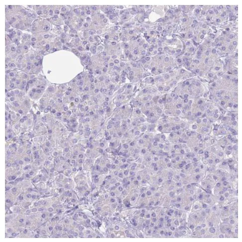 Immunohistochemistry (Formalin/PFA-fixed paraffin-embedded sections) - Anti-RHCG antibody (AB187904)
