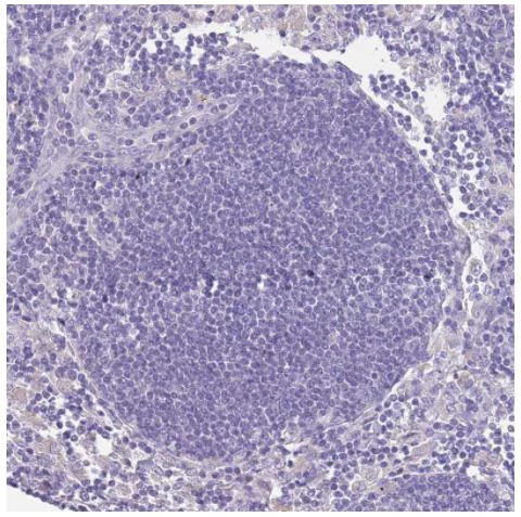 Immunohistochemistry (Formalin/PFA-fixed paraffin-embedded sections) - Anti-RHCG antibody (AB187904)