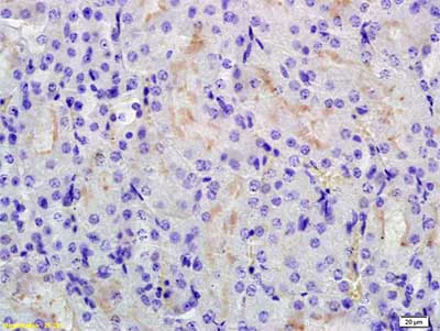 Immunohistochemistry (Formalin/PFA-fixed paraffin-embedded sections) - Anti-RHCG antibody (AB203666)