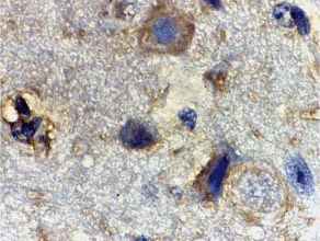 Immunohistochemistry (Formalin/PFA-fixed paraffin-embedded sections) - Anti-RHEB antibody (AB25873)