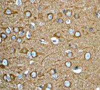 Immunohistochemistry (Formalin/PFA-fixed paraffin-embedded sections) - Anti-RHEB antibody [EPR2971] (ab92313), expandable thumbnail