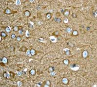 Immunohistochemistry (Formalin/PFA-fixed paraffin-embedded sections) - Anti-RHEB antibody [EPR2971] (AB92313)