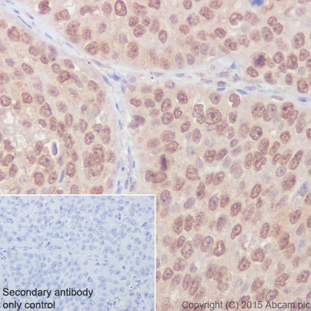 Immunohistochemistry (Formalin/PFA-fixed paraffin-embedded sections) - Anti-Rho A + B + C antibody [EPR18299] (AB188103)