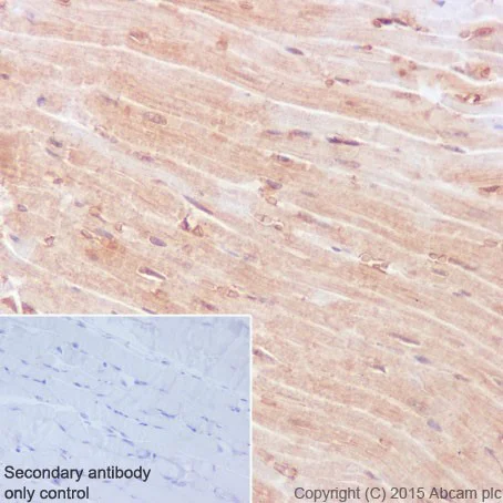 Immunohistochemistry (Formalin/PFA-fixed paraffin-embedded sections) - Anti-Rho A + B + C antibody [EPR18299] (AB188103)