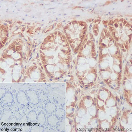Immunohistochemistry (Formalin/PFA-fixed paraffin-embedded sections) - Anti-Rho A + B + C antibody [EPR18299] (AB188103)
