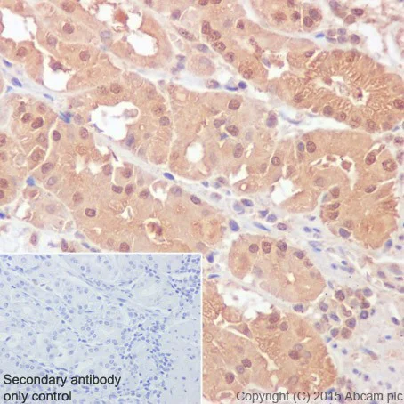 Immunohistochemistry (Formalin/PFA-fixed paraffin-embedded sections) - Anti-Rho A + B + C antibody [EPR18299] (AB188103)