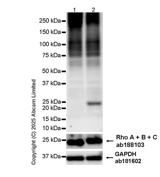 Western blot - Anti-Rho A + B + C antibody [EPR18299] (AB188103)