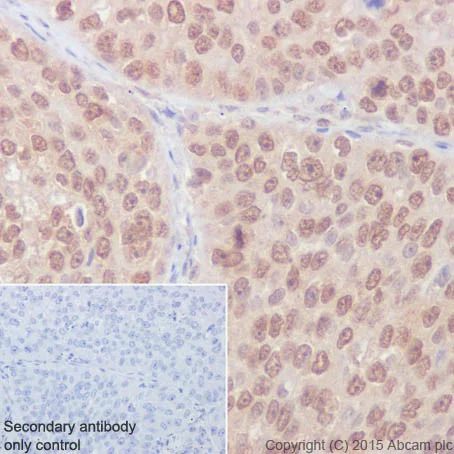 Immunohistochemistry (Formalin/PFA-fixed paraffin-embedded sections) - Anti-Rho A + B + C antibody [EPR18299] - BSA and Azide free (AB221161)