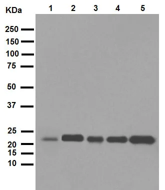 Western blot - Anti-Rho antibody [EP487Y] (AB40673)