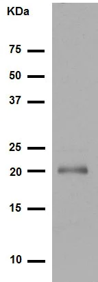 Western blot - Anti-Rho antibody [EP487Y] (AB40673)