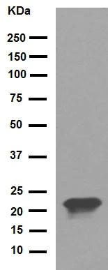 Western blot - Anti-Rho antibody [EP487Y] (AB40673)