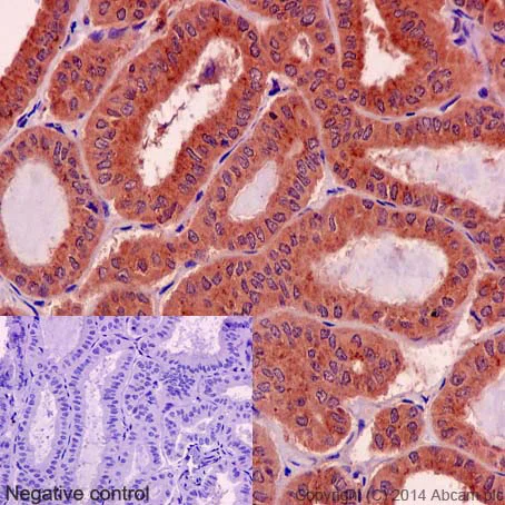 Immunohistochemistry (Formalin/PFA-fixed paraffin-embedded sections) - Anti-Rho antibody [EP487Y] - BSA and Azide free (AB239825)