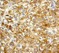 Immunohistochemistry (Formalin/PFA-fixed paraffin-embedded sections) - Anti-Rho antibody [Y486] - BSA and Azide free (AB247214)