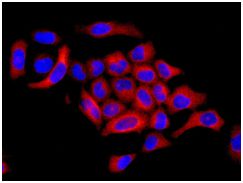 Immunocytochemistry/ Immunofluorescence - Anti-Rho guanine exchange factor 16/NBR antibody [EPR9950] (AB154785), expandable thumbnail