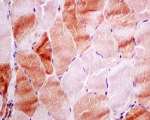 Immunohistochemistry (Formalin/PFA-fixed paraffin-embedded sections) - Anti-Rho guanine exchange factor 16/NBR antibody [EPR9950] (ab154785), expandable thumbnail