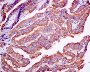 Immunohistochemistry (Formalin/PFA-fixed paraffin-embedded sections) - Anti-Rho guanine exchange factor 16/NBR antibody [EPR9950] (ab154785), expandable thumbnail