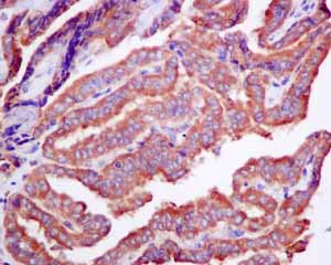 Immunohistochemistry (Formalin/PFA-fixed paraffin-embedded sections) - Anti-Rho guanine exchange factor 16/NBR antibody [EPR9950] (AB154785)