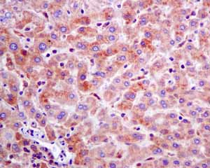 Immunohistochemistry (Formalin/PFA-fixed paraffin-embedded sections) - Anti-Rho guanine exchange factor 16/NBR antibody [EPR9950] (ab154785), expandable thumbnail