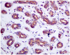 Immunohistochemistry (Formalin/PFA-fixed paraffin-embedded sections) - Anti-Rho guanine exchange factor 16/NBR antibody [EPR9950] (AB154785), expandable thumbnail